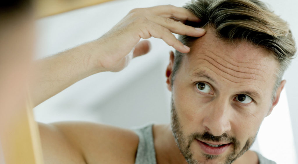 CBD for Hair Loss